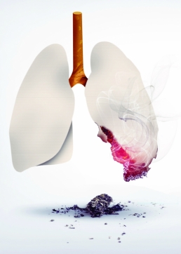 lung cancer screening in Brooklyn, ny